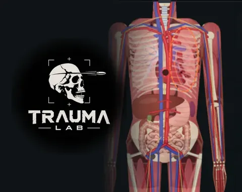Trauma Lab Bones: X-Ray Controls and Fracture Repair